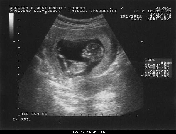 -31409-baby1_12weeks.jpg